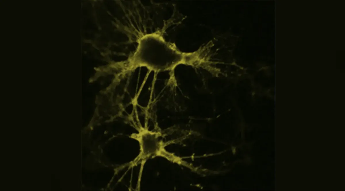 How Geometry and Combinatorics Tame the Networks in your Brain